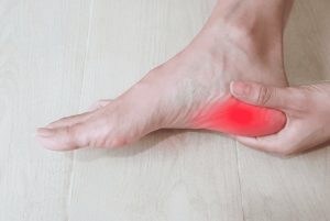 Plantar Fasciitis